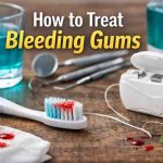 How to Treat Bleeding Gums 9 Honest Fixes That Finally Bring Relief