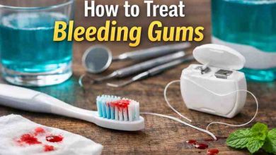 How to Treat Bleeding Gums 9 Honest Fixes That Finally Bring Relief