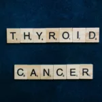 Thyroid Cancer Symptoms & Treatment