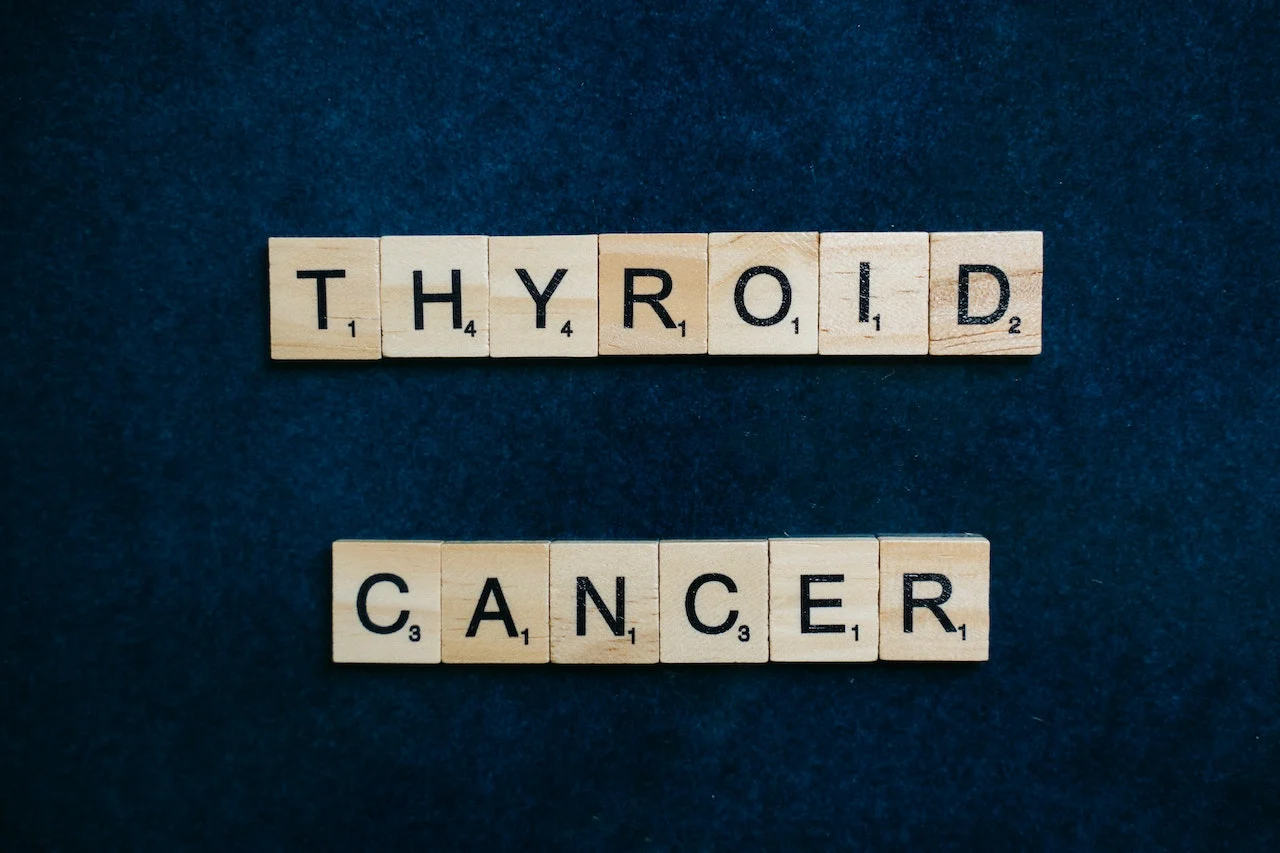 Thyroid cancer symptoms & treatment