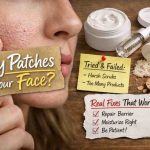 Dry Patches on Your Face 9 Honest Fixes That Actually Bring Relief