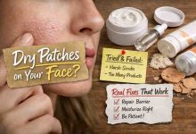 Dry Patches on Your Face 9 Honest Fixes That Actually Bring Relief