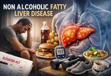 Non Alcoholic Fatty Liver Disease 9 Hard Truths Real Relief and What Actually Works