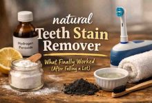 Natural Teeth Stain Remover 9 Real Lessons From Frustration to Actual Relief
