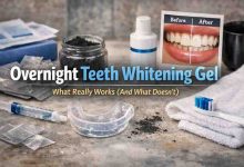 Overnight Teeth Whitening Gel 7 Real Lessons I Learned the Hard Way — Relief After Months of Frustration