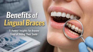 Benefits of Lingual Braces 11 Honest Insights for Anyone Tired of Hiding Their Smile