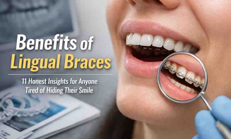 Benefits of Lingual Braces 11 Honest Insights for Anyone Tired of Hiding Their Smile