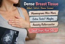 Dense Breast Tissue 9 Hard Truths Real Relief and Why This Frustrated Me at First