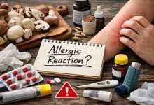 Allergic Reaction to Mushrooms 9 Frustrating Signs Ive Seen and What Actually Brings Relief