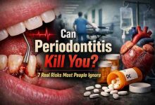 Can Periodontitis Kill You 7 Real Risks Most People Ignore and the Relief of Knowing the Truth