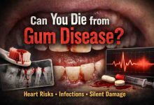 Can You Die from Gum Disease 7 Hard Truths Most People Learn Too Late and Why Theres Still Hope