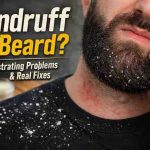 Dandruff in Beard 9 Frustrating Truths What Actually Brings Relief