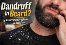 Dandruff in Beard 9 Frustrating Truths What Actually Brings Relief