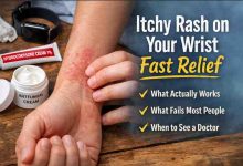 Itchy Rash on Your Wrist Fast Relief 9 Real World Fixes That Actually Work