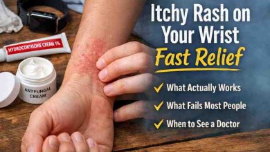 Itchy Rash on Your Wrist Fast Relief 9 Real World Fixes That Actually Work