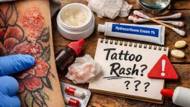 Ways to Address Rash on Tattoo 13 Honest Fixes That Bring Relief Before You Panic Usual Frustration