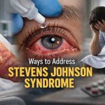 Ways to Address Steven Johnson Syndrome 9 Hard Lessons That Bring Real Relief