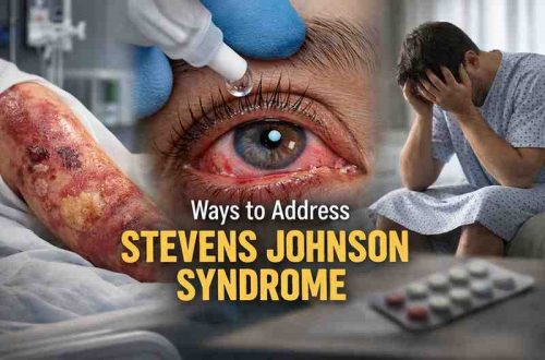 Ways to Address Steven Johnson Syndrome 9 Hard Lessons That Bring Real Relief