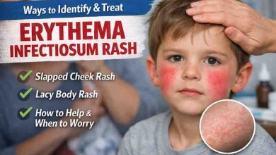 Ways to Identify and Treat Erythema Infectiosum Rash 9 Real World Insights That Bring Relief