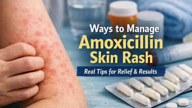 Ways to Manage Amoxicillin Skin Rash 9 Grounded Steps for Relief and Realistic Hope