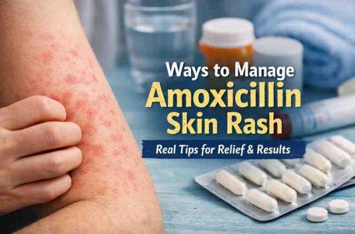 Ways to Manage Amoxicillin Skin Rash 9 Grounded Steps for Relief and Realistic Hope Ways to Manage Amoxicillin Skin Rash 9 Grounded Steps for Relief and Realistic Hope
