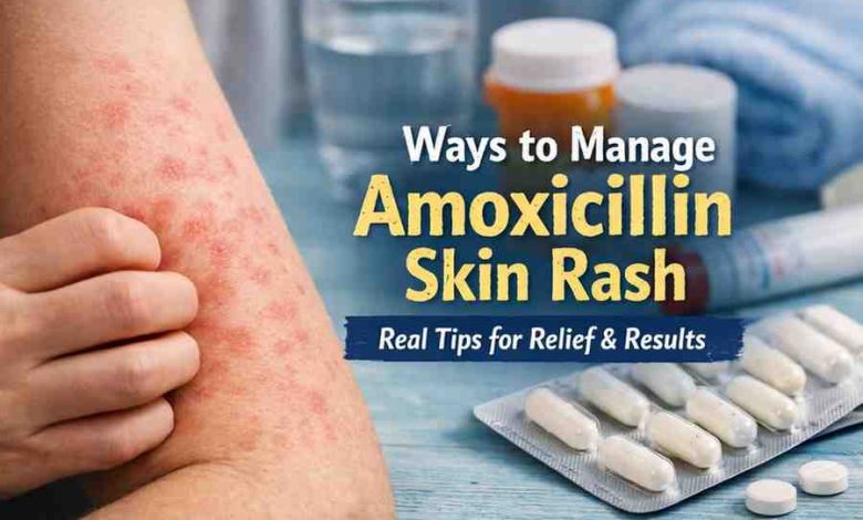 Ways to Manage Amoxicillin Skin Rash 9 Grounded Steps for Relief and Realistic Hope