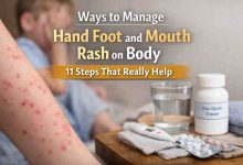 Ways to Manage Hand Foot and Mouth Rash on Body 11 Grounded Steps That Actually Bring Relief