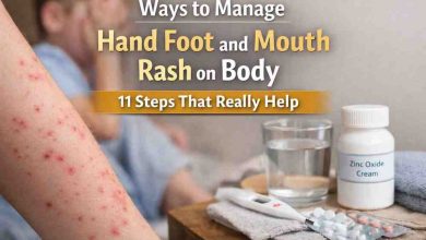 Ways to Manage Hand Foot and Mouth Rash on Body 11 Grounded Steps That Actually Bring Relief