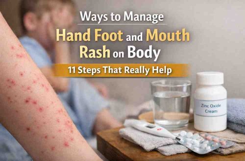 Ways to Manage Hand Foot and Mouth Rash on Body 11 Grounded Steps That Actually Bring Relief Ways to Manage Hand Foot and Mouth Rash on Body 11 Grounded Steps That Actually Bring Relief