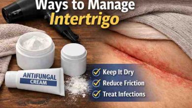 Ways to Manage Intertrigo 17 Grounded Strategies for Real Relief Without the Usual Frustration
