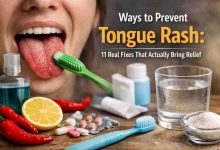 Ways to Prevent Tongue Rash 11 Real Fixes That Actually Bring Relief