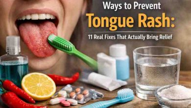 Ways to Prevent Tongue Rash 11 Real Fixes That Actually Bring Relief