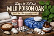 Ways to Relieve Mild Poison Oak 11 Real Fixes That Actually Bring Relief Without Making It Worse