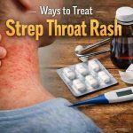 Ways to Treat Strep Throat Rash 11 Grounded Approaches That Actually Bring Relief
