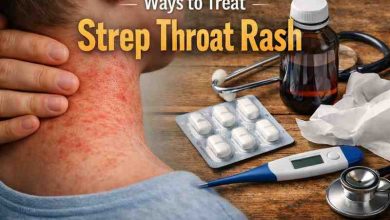 Ways to Treat Strep Throat Rash 11 Grounded Approaches That Actually Bring Relief