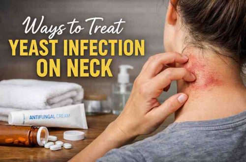 Ways to Treat Yeast Infection on Neck 11 Real Relief Strategies That Actually Work Ways to Treat Yeast Infection on Neck 11 Real Relief Strategies That Actually Work