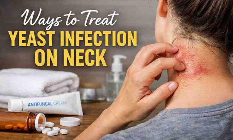Ways to Treat Yeast Infection on Neck 11 Real Relief Strategies That Actually Work