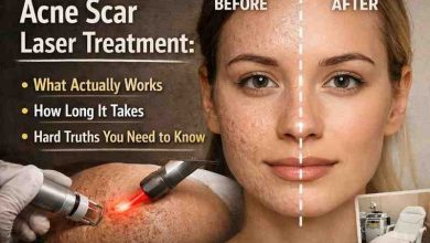 Acne Scar Laser Treatment 7 Hard Truths Real Relief What Actually Works
