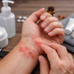 Red Blotches On Wrist 9 Real Patterns Ive Seen And What Actually Brings Relief 1