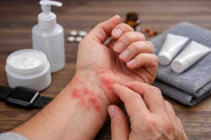 Red Blotches On Wrist 9 Real Patterns Ive Seen And What Actually Brings Relief 1