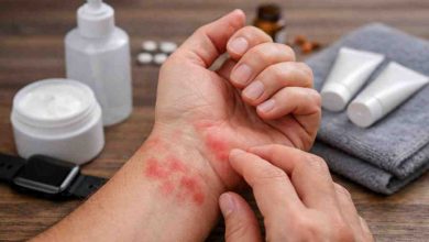 Red Blotches on Wrist 9 Real Patterns Ive Seen and What Actually Brings Relief