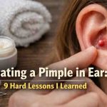 Treating a Pimple in Ear 9 Hard Lessons That Finally Brought Relief