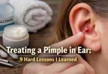 Treating a Pimple in Ear 9 Hard Lessons That Finally Brought Relief