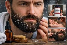 Ways to Beat Dandruff in Beard 9 Real Fixes for Frustration and Finally Getting Relief