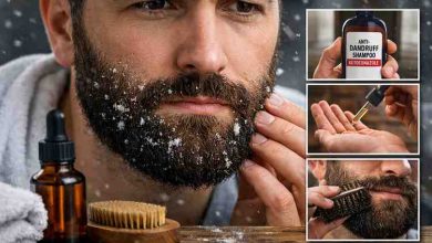 Ways to Beat Dandruff in Beard 9 Real Fixes for Frustration and Finally Getting Relief