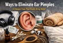 Ways to Eliminate Ear Pimples 13 Honest Fixes That Finally Bring Relief