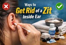 Ways to Get Rid of a Zit Inside Ear 9 Relief Focused Fixes Frustration → Real Relief