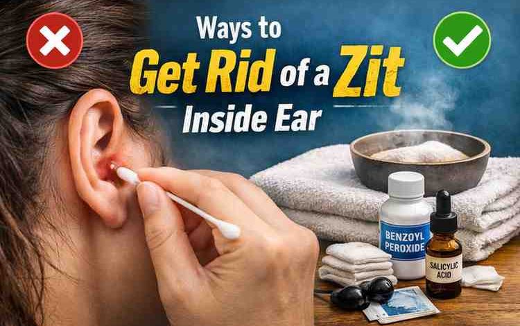 Ways to Get Rid of a Zit Inside Ear 9 Relief Focused Fixes Frustration → Real Relief
