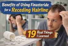 Benefits of Using Finasteride for a Receding Hairline: 19 Things I Learned the Messy, Hard, Panic-Filled Way