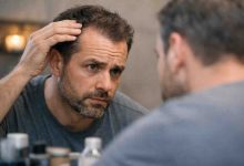 Maturing Hairline: 9 Brutal Truths That Finally Made Me Feel Better About Mine